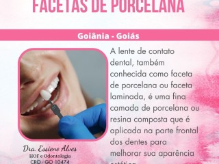 facetas-porcelana-goiania-goias